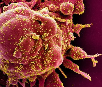 anti parasite drug can kill coronavirus found by researchers in australia